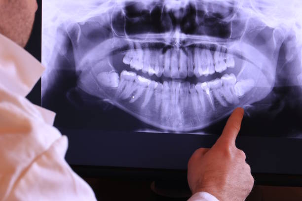 Best Teeth Whitening  in North Charleston, SC
